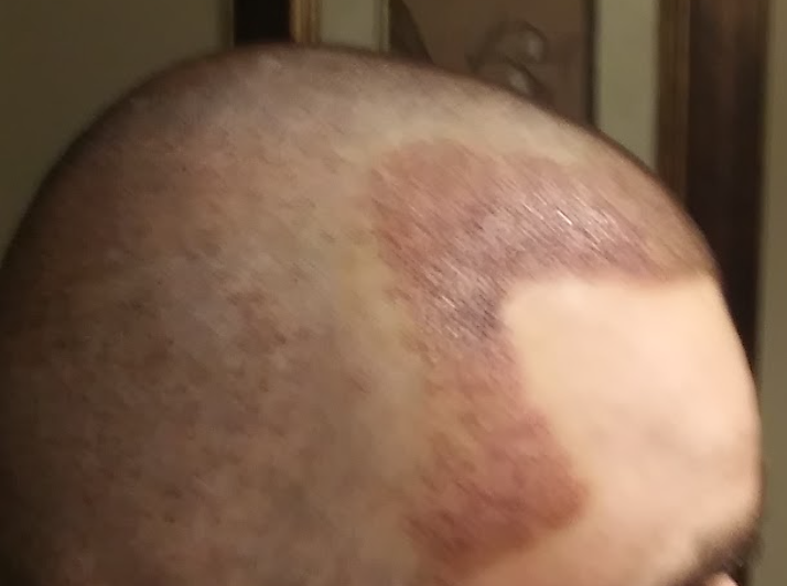 Pic 6.png