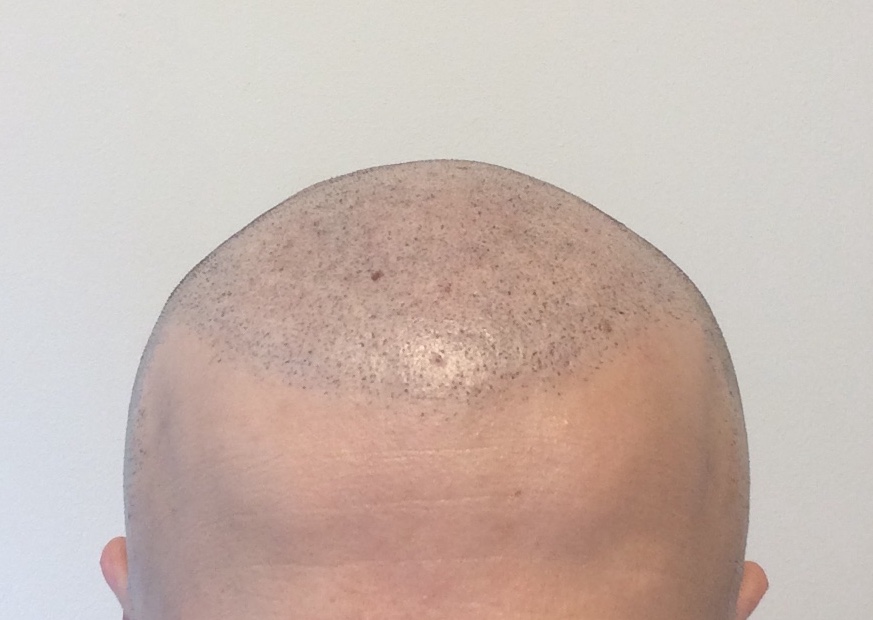 picture1.jpg