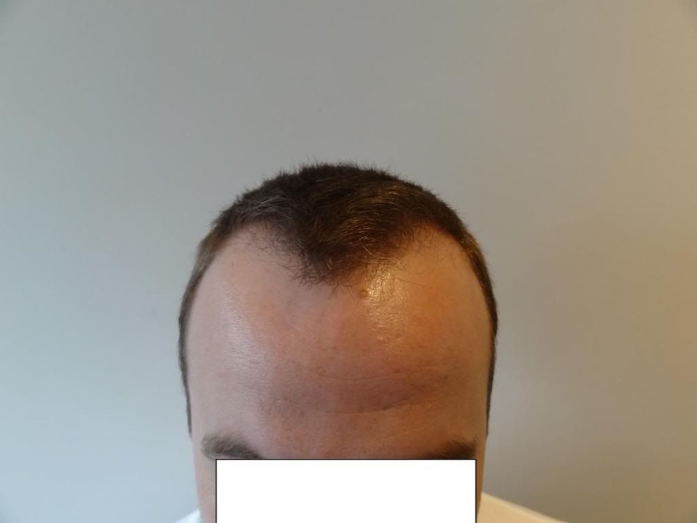Prohair clinic 2.jpg