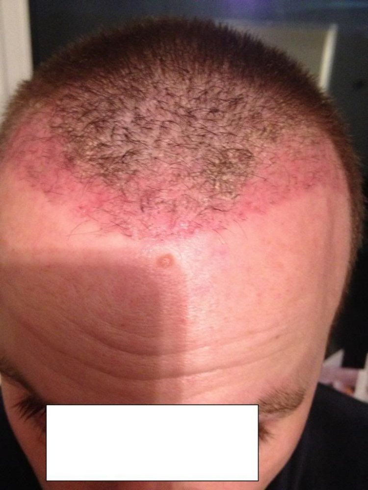 Prohair clinic Belgium.jpg