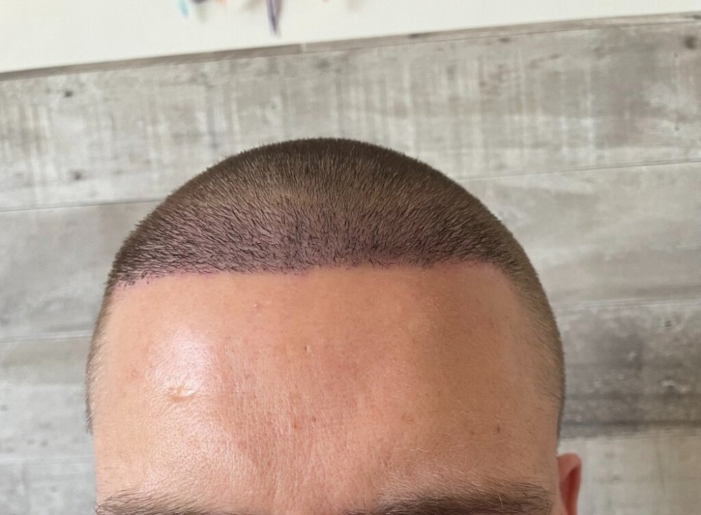 Pst Op day 7 - Hair Center.jpeg