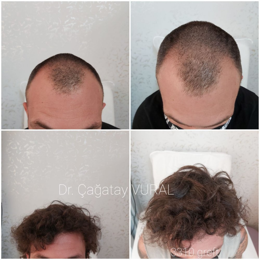 Result Picture 1 year.jpg