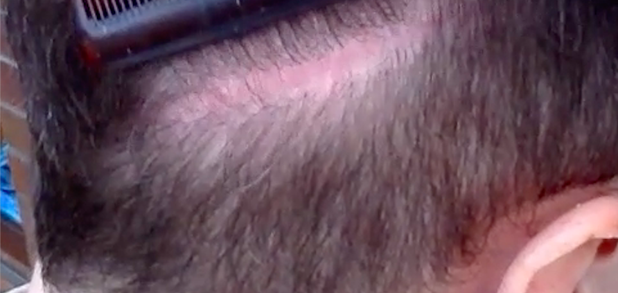Scar.png