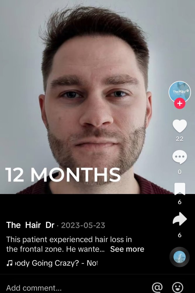 Screenshot_20240117_013640_TikTok.jpg
