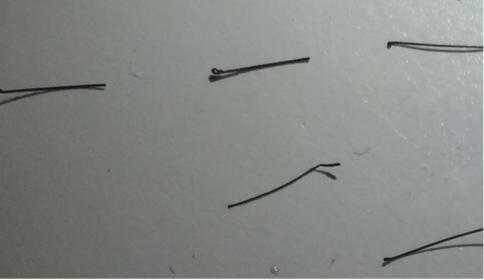 shed hair grafts.jpg