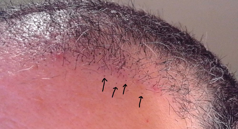 short hairs.jpg