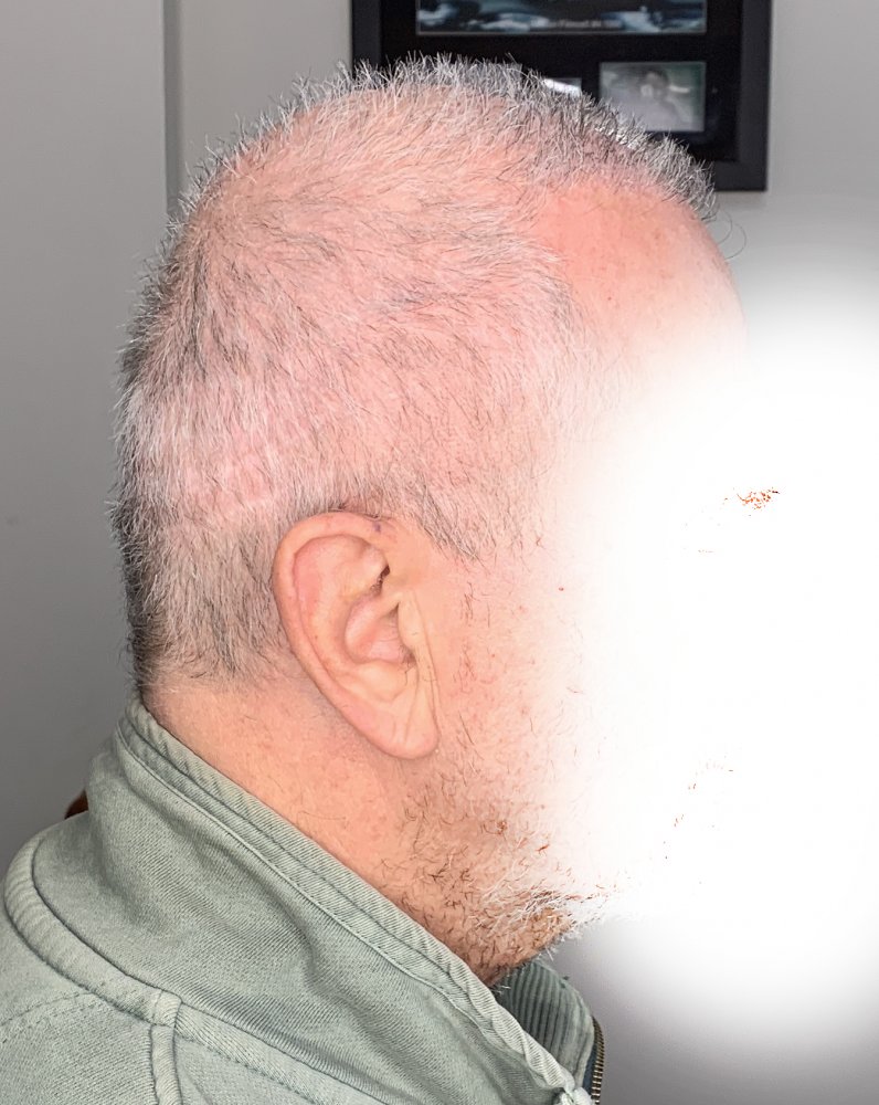Side_Right_1.jpg
