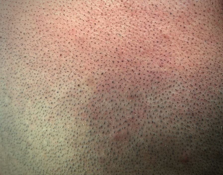 SMP Close Up.jpeg