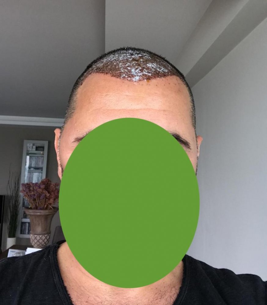 swelling.jpg
