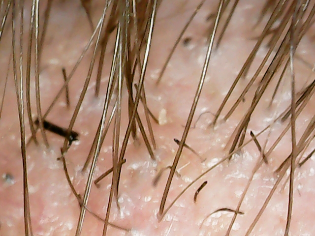 T20220722_001_0126.jpg