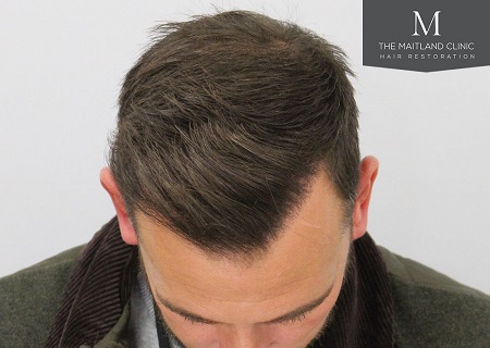 The Maitland Clinic Review10.jpg