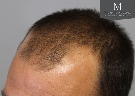 The Maitland Clinic Review17.jpg