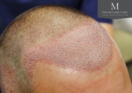 The Maitland Clinic Review19.jpg