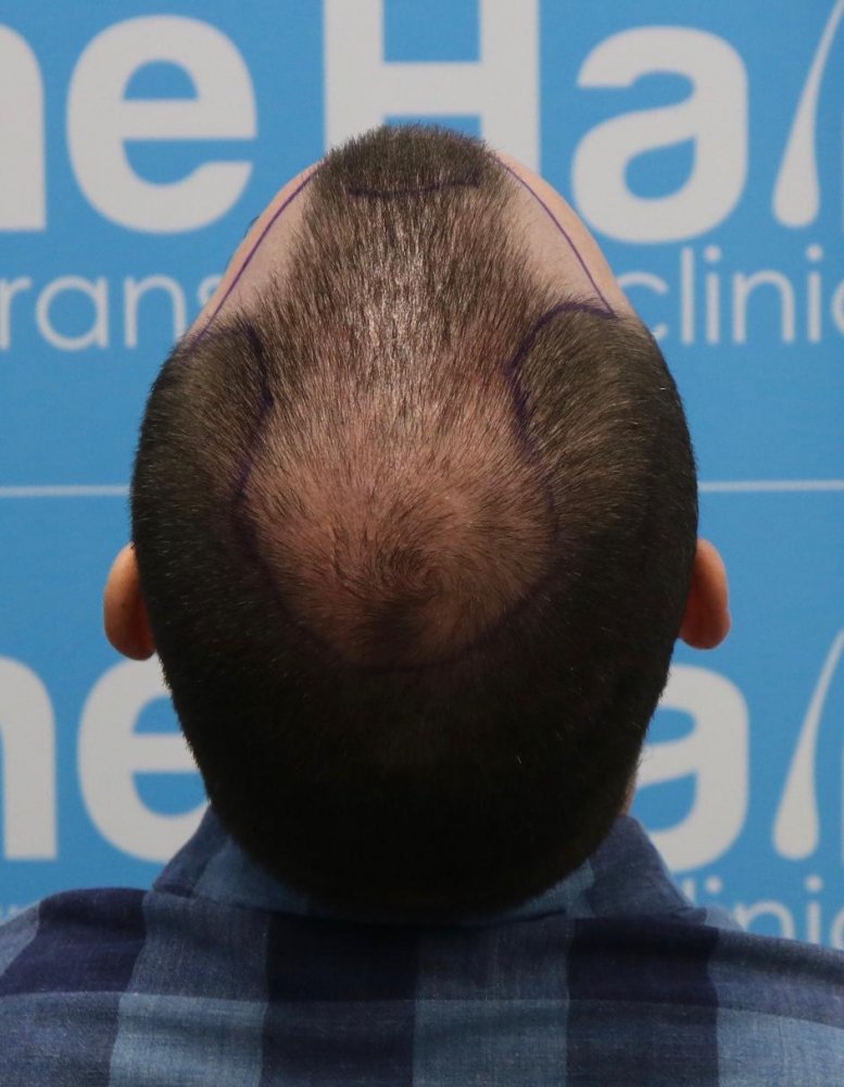 Top image hair dr clinic.jpg