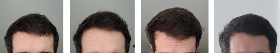 Update pic1.jpg