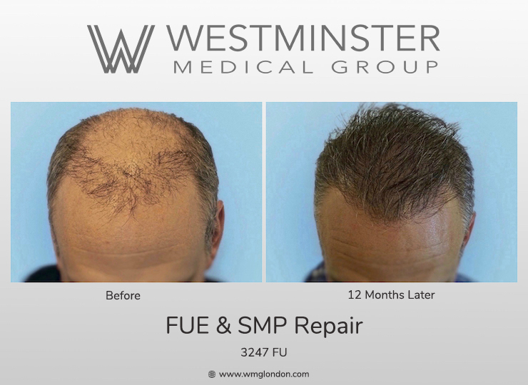 WMG Repair case.jpg