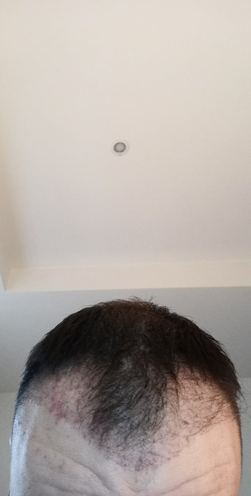 xa.jpg