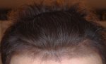 3months-10days-0.jpg