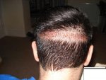 10 days staple out.JPG