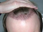 hairline1.jpg