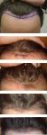 comparison 0-4 months Kopie.jpg