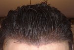 5monthswetcombedback2.jpg
