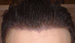 5monthswetcombedback3.jpg