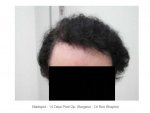 FrontDry01.jpg