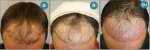 _CORRECTION_ANTERIOR_LINE (1).jpg