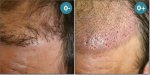 _CORRECTION_ANTERIOR_LINE (3).jpg