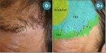 _CORRECTION_ANTERIOR_LINE (4).jpg