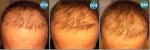_CORRECTION_ANTERIOR_LINE (5).jpg
