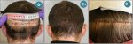 _CORRECTION_ANTERIOR_LINE (7).jpg