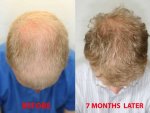 LEGRAND-Gregoire-Before-after1.jpg