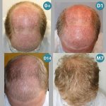 LEGRAND-Gregoire-Before-after3.jpg