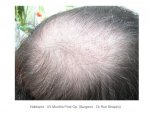 Crown01.jpg
