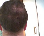 unshaveback.jpg