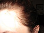 myhairline_005.jpg