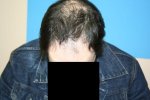 before pics2.JPG