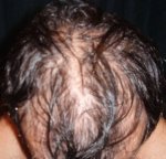 top wet hair.jpg
