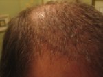right front 4 months..jpg
