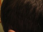 left side scar line..jpg