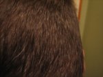 right side scar-line..jpg
