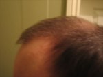 left side 4 months..jpg