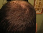 4 months update hair picks 012.jpg