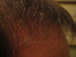 6 months right side.jpg