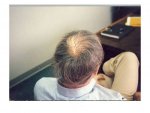 thinning crown.JPG