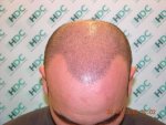 1 week after Front.JPG
