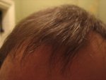 10 months front dry..jpg