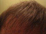 10 monthd front right dry..jpg